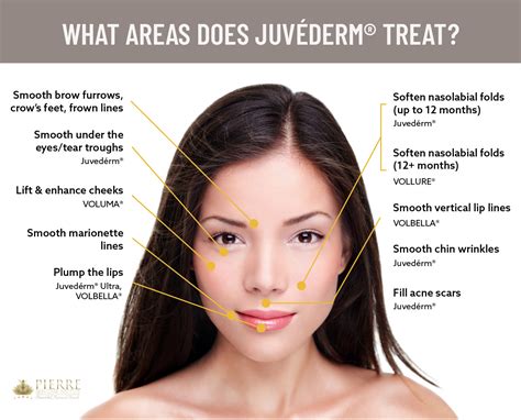 Juvederm: What it is, How it Works, and What you Can Expect.